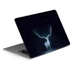 Decorative Diy Laptop Skin Stickers For Macbookhpdellasus1217 Inch - 2